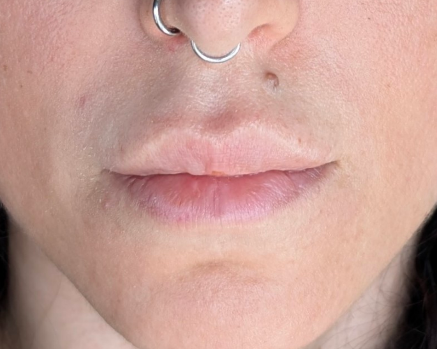 Lips After