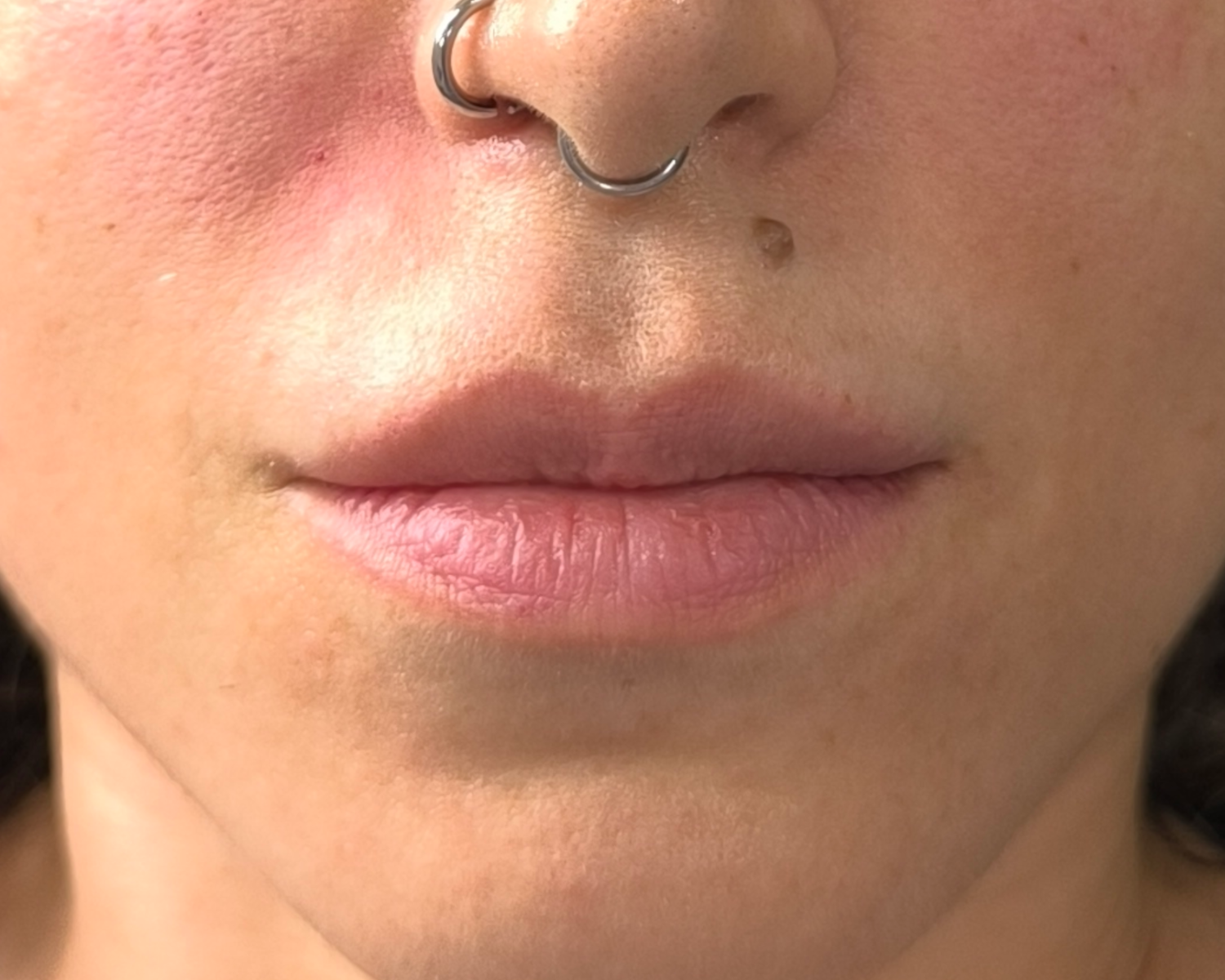 Lips Before