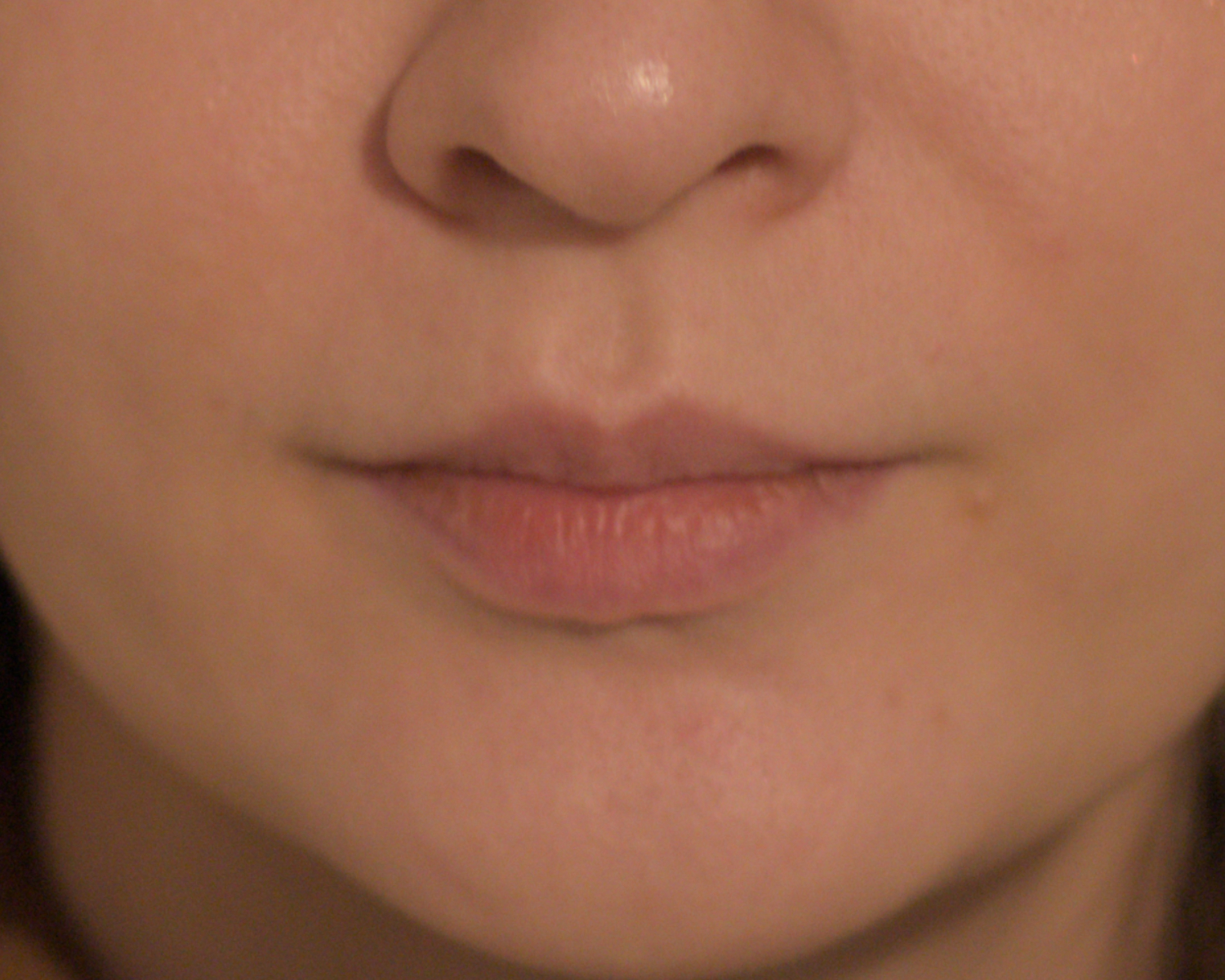 Eunice - Lips Before-1