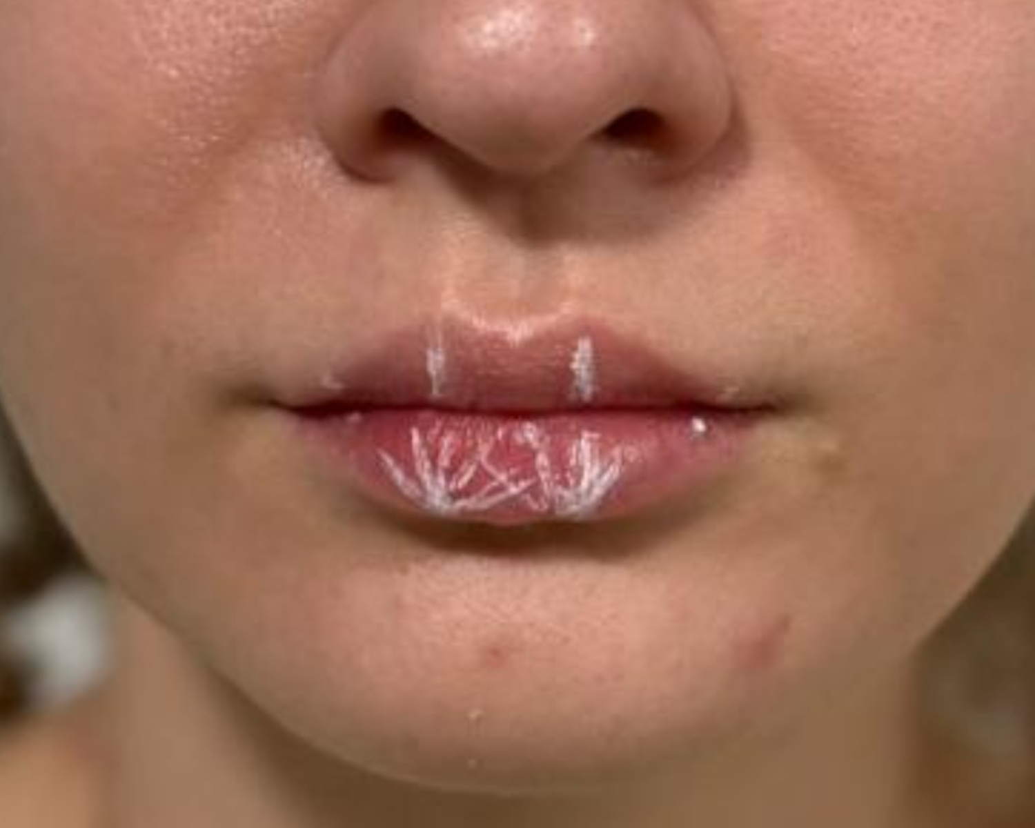 Eunice - Lips Before