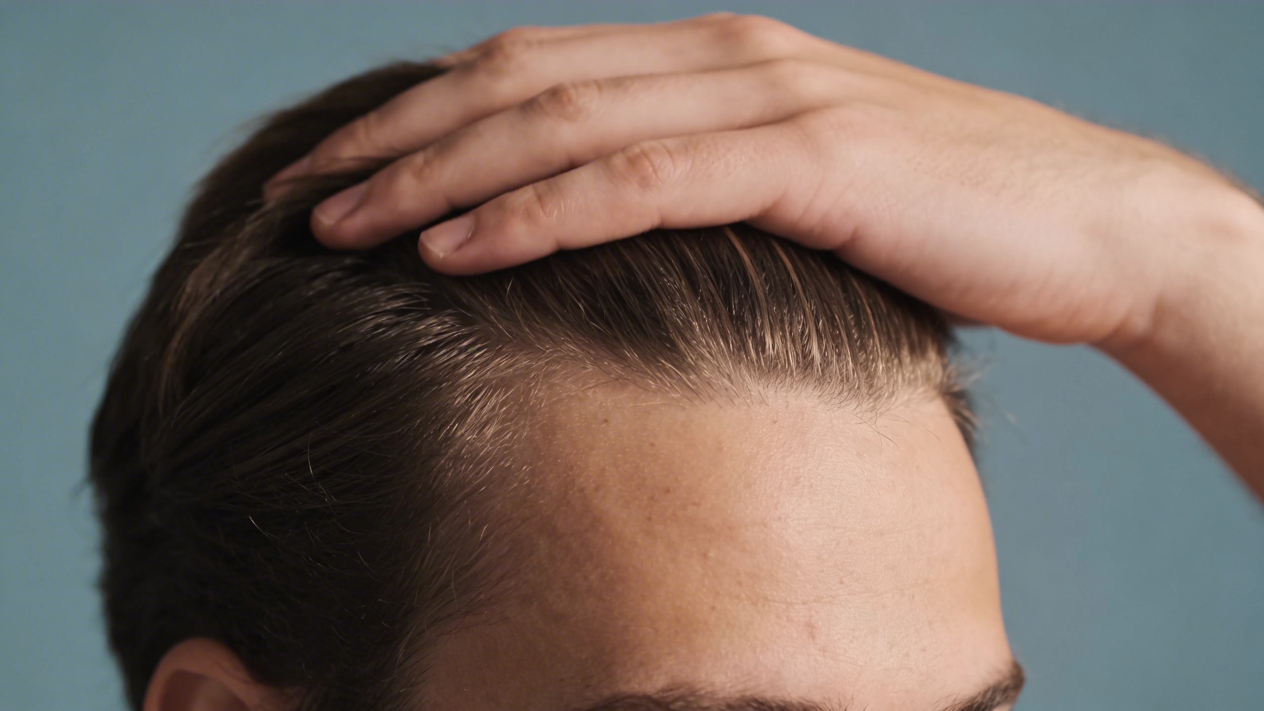 Young man with hair thinning