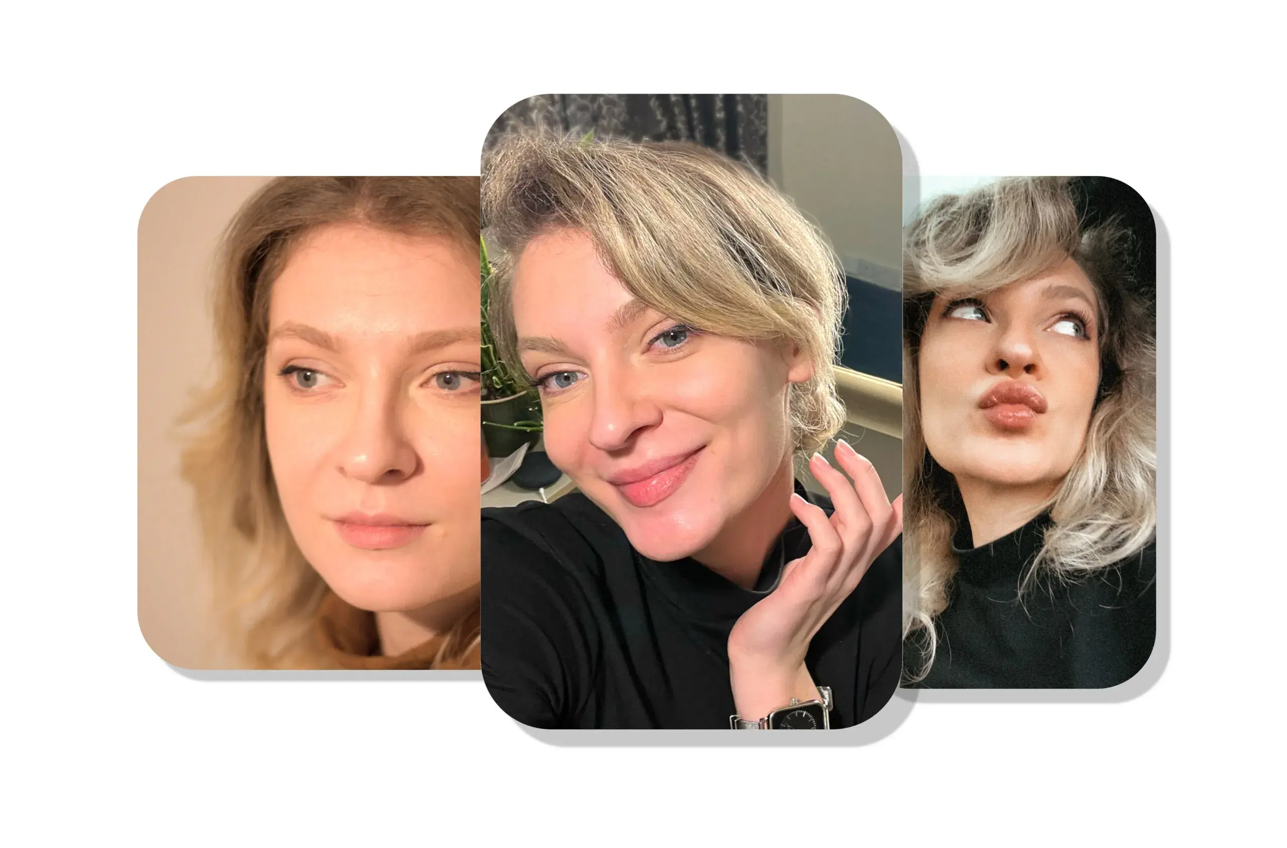 Glowing face before and after subtle changes with treatments of neurotoxins and fillers