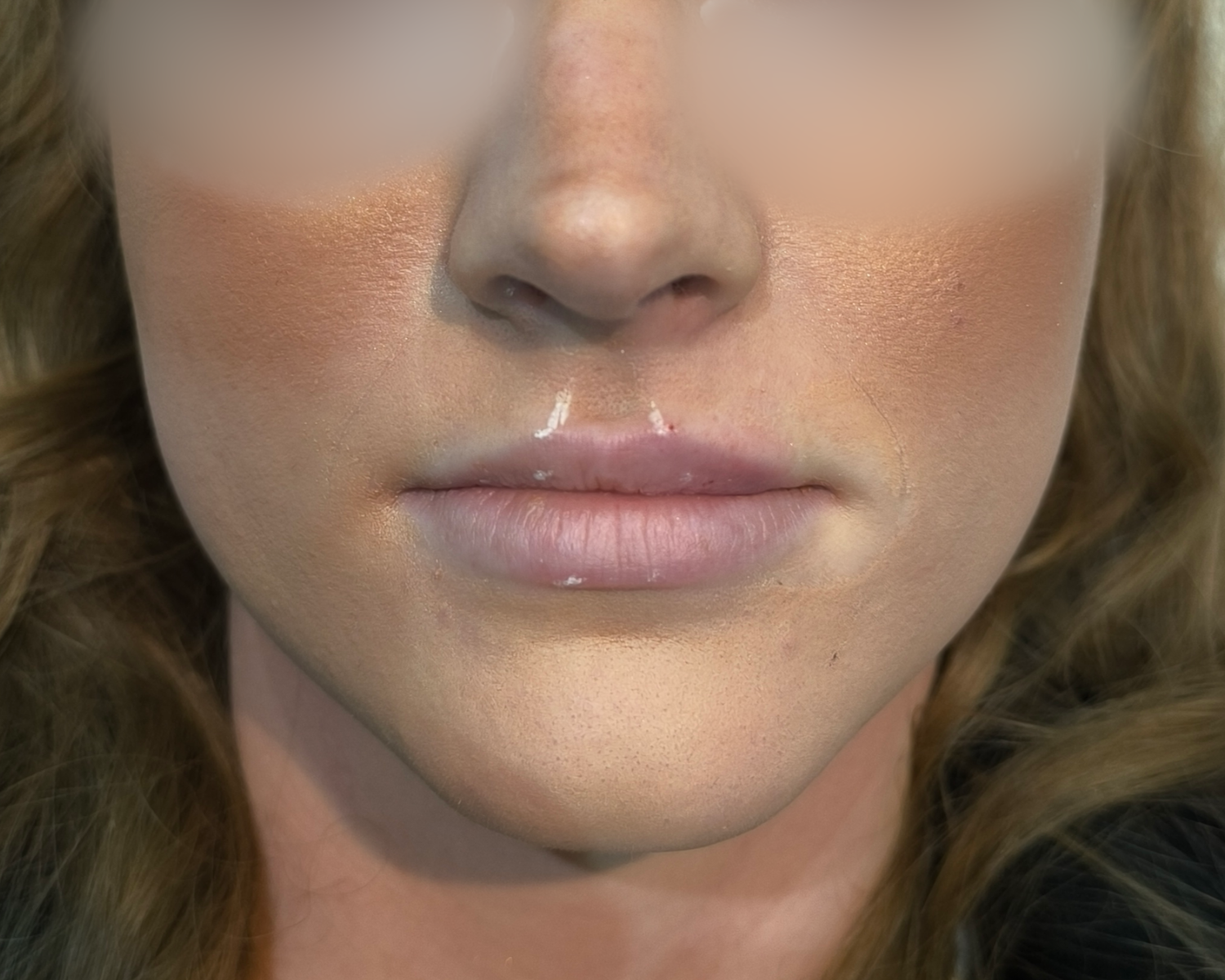 Zahra Lips Before